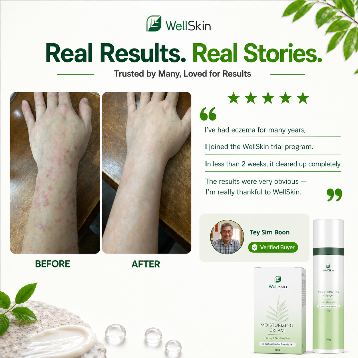 【Skin Repair】WellSkin Herbal Cream